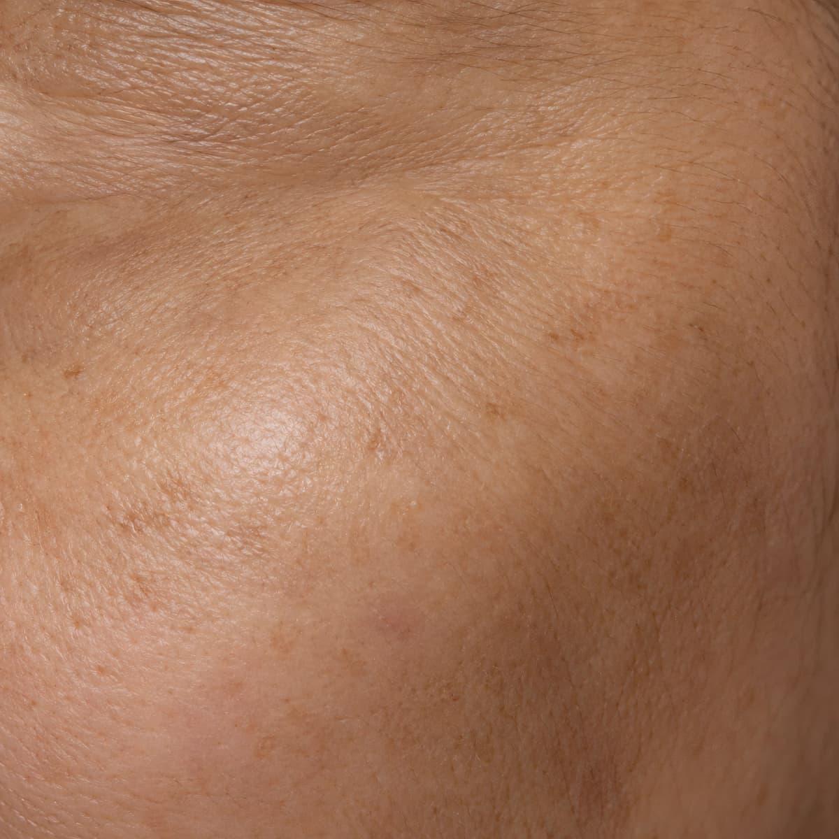 Close-up skin sample for Anti-Aging System
