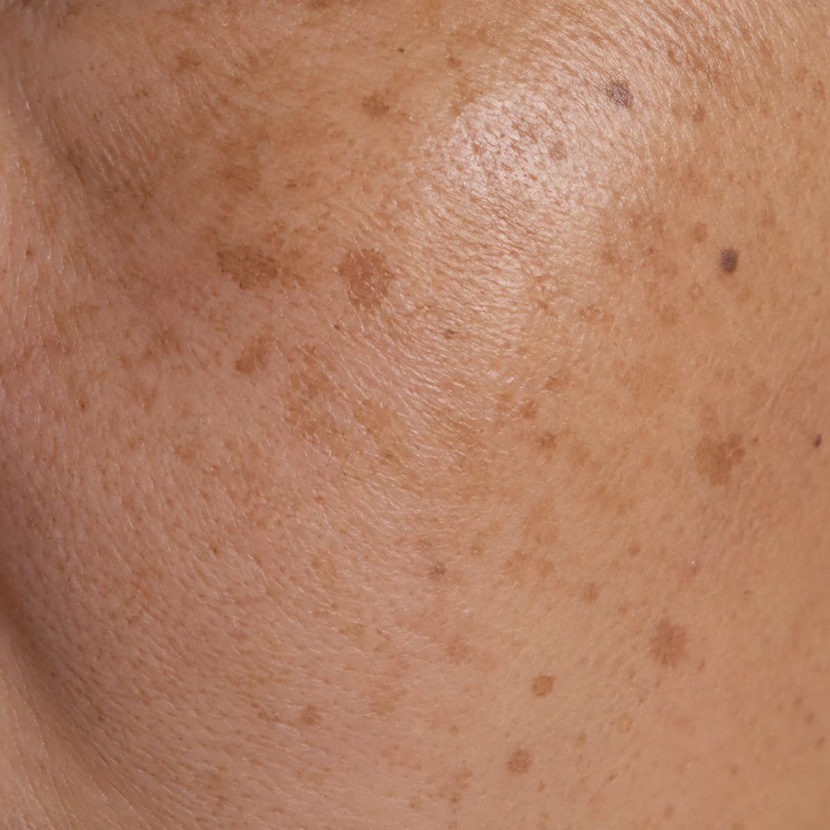 Close-up skin sample for Pigment System