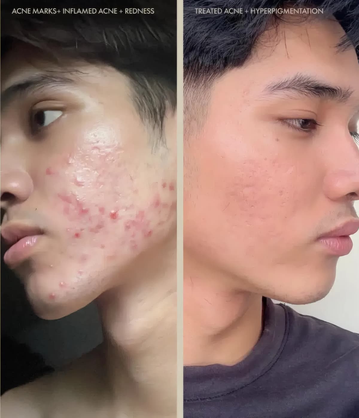 VCM patient result, before